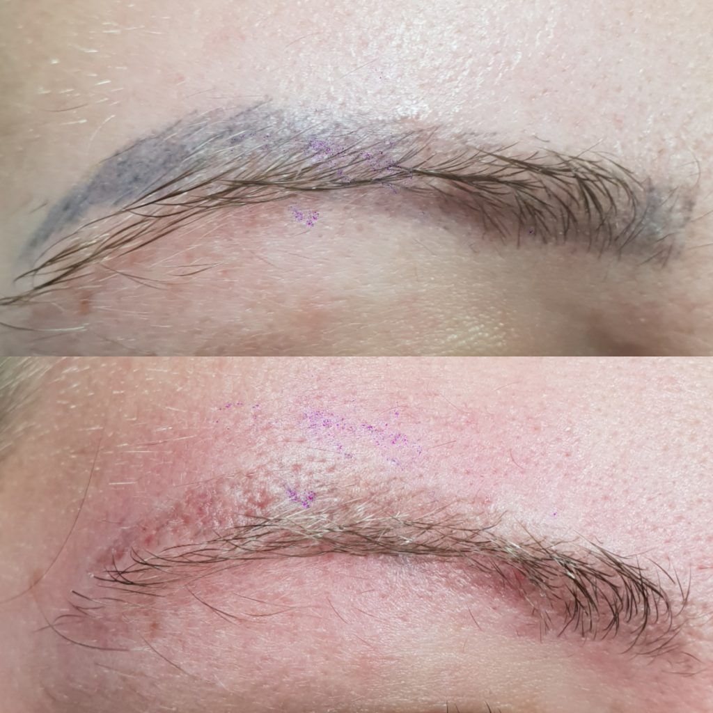 Does Permanent Makeup Microblading Fade Completely